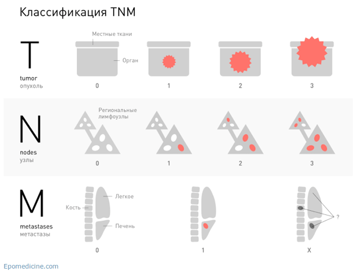 классификация TNM